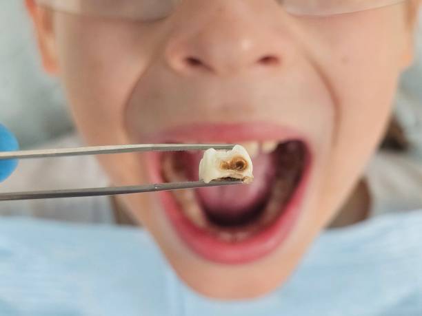 Best Broken or Cracked Tooth Emergency Dentist in Farngton, MI